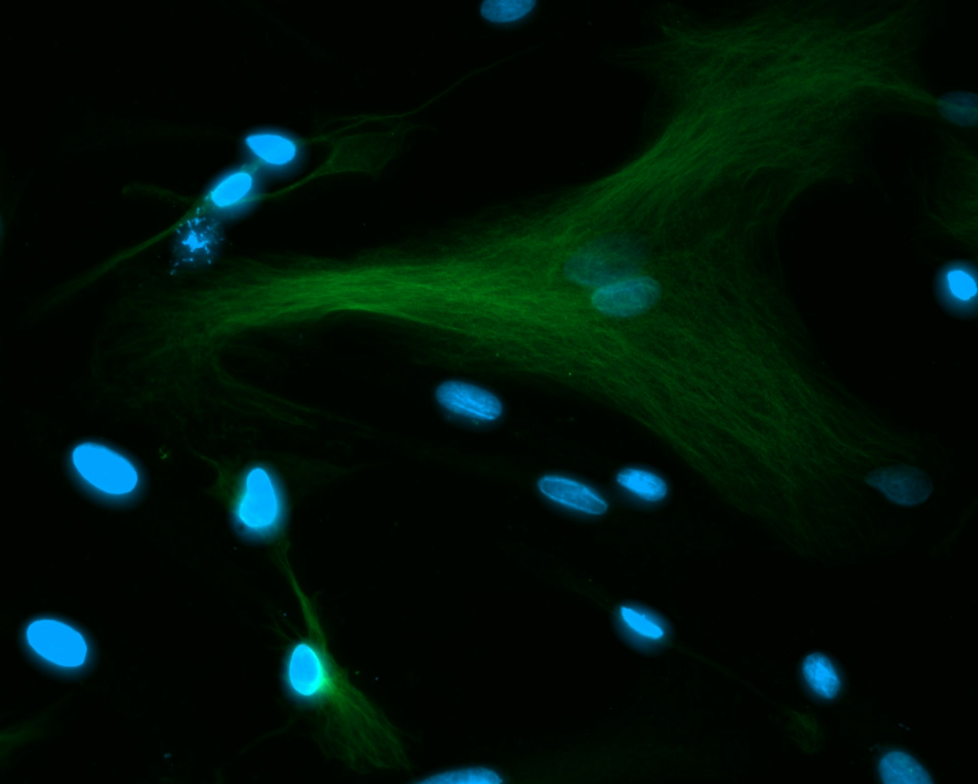 Fluorescence micrograph of cultured cells: green filament networks threading between bright blue-stained nuclei